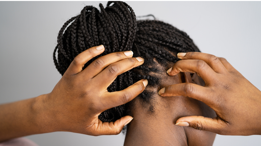 Say Goodbye to Itchy Scalp This Winter with Lavish Wellness Shop’s Natural Scalp Oils